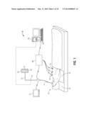 BLEEDING CONTAINMENT DEVICE diagram and image