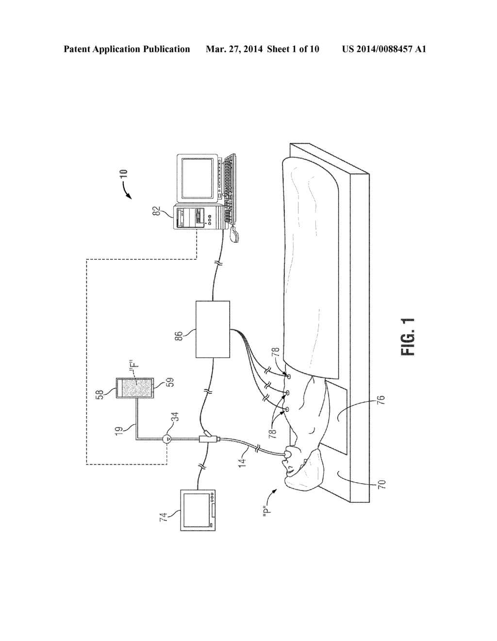 BLEEDING CONTAINMENT DEVICE - diagram, schematic, and image 02