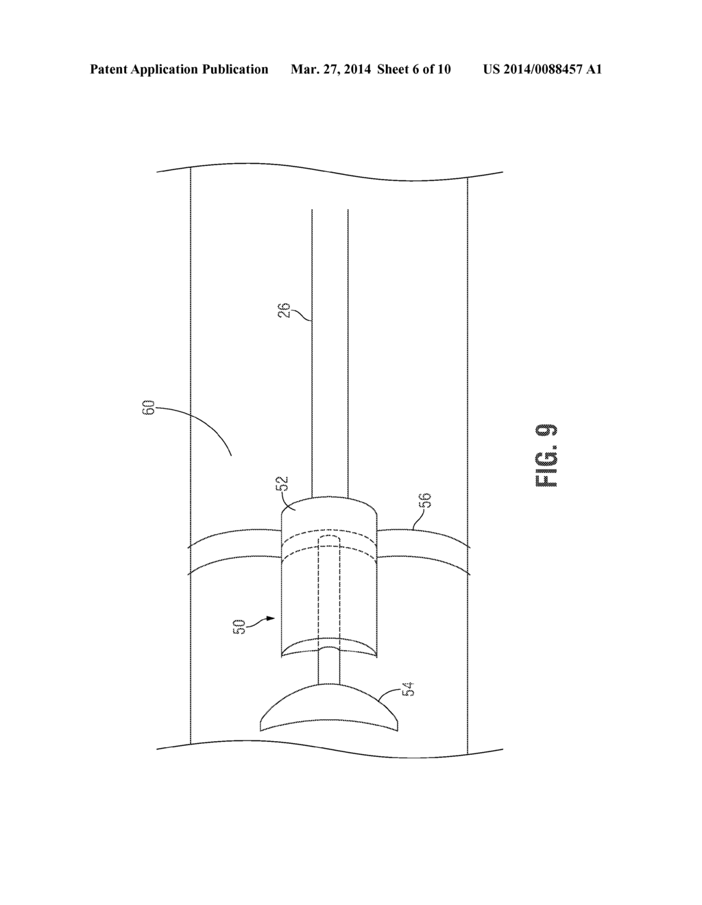 BLEEDING CONTAINMENT DEVICE - diagram, schematic, and image 07