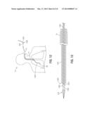 BLEEDING CONTAINMENT DEVICE diagram and image