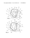 Blood Flow Reversal Valves and Related Systems and Methods diagram and image