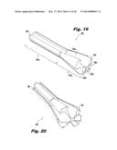 Devices and methods for automated surgery diagram and image