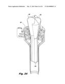 Devices and methods for automated surgery diagram and image