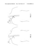 Methods and Apparatus for Inserting Multi-Lumen Split-Tip Catheters Into a     Blood Vessel diagram and image
