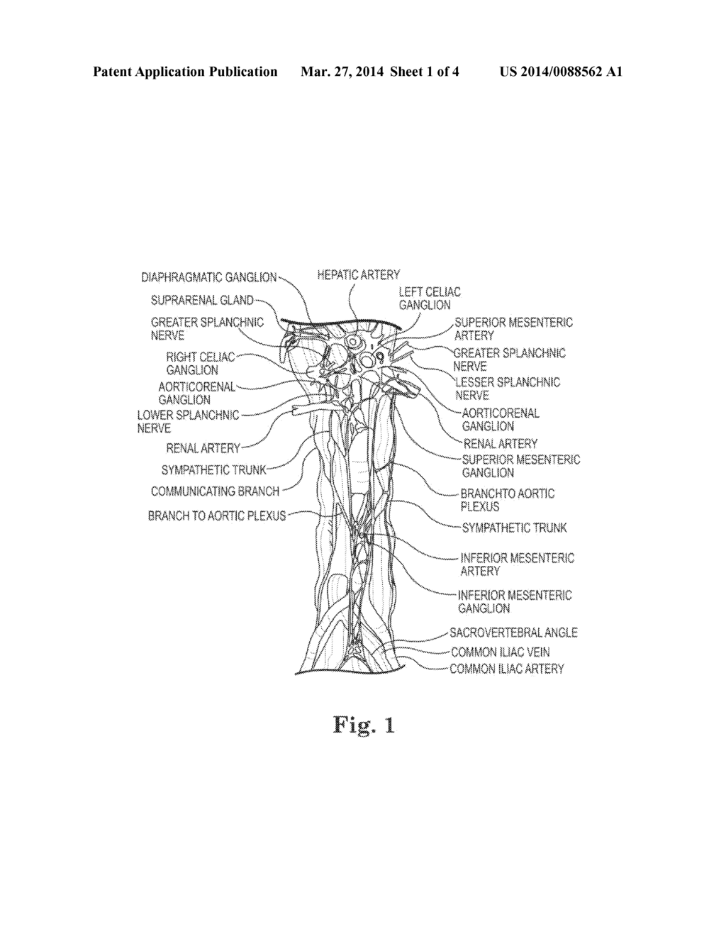 SYSTEM AND METHOD OF PRE-AORTIC GANGLION ABLATION - diagram, schematic, and image 02