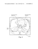 SYSTEM AND METHOD OF PRE-AORTIC GANGLION ABLATION diagram and image