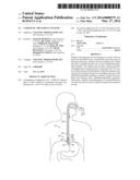 CYROGENIC TREATMENT SYSTEMS diagram and image