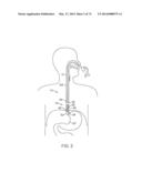 CYROGENIC TREATMENT SYSTEMS diagram and image