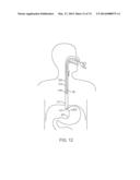 CYROGENIC TREATMENT SYSTEMS diagram and image