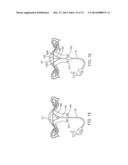 CYROGENIC TREATMENT SYSTEMS diagram and image