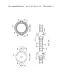 CYROGENIC TREATMENT SYSTEMS diagram and image