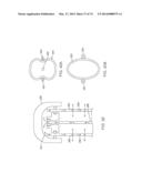 CYROGENIC TREATMENT SYSTEMS diagram and image