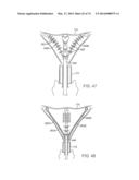 CYROGENIC TREATMENT SYSTEMS diagram and image