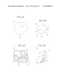 METHODS AND APPARATUS FOR PREPARING A PATIENT S FEMUR FOR PATELLOFEMORAL     KNEE ARTHROPLASTY diagram and image