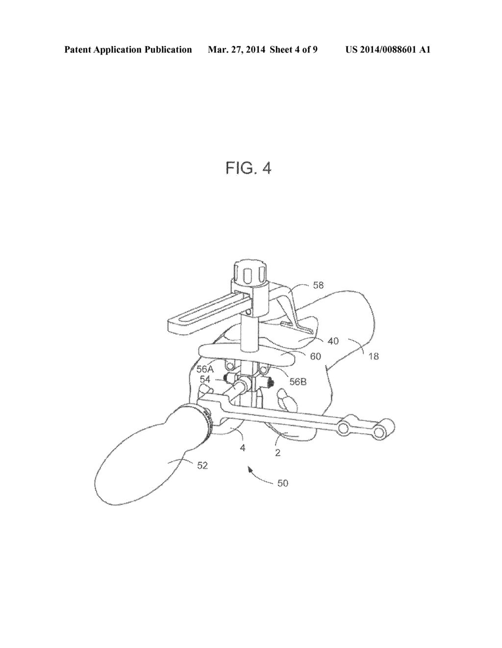 METHODS AND APPARATUS FOR PREPARING A PATIENT'S FEMUR FOR PATELLOFEMORAL     KNEE ARTHROPLASTY - diagram, schematic, and image 05