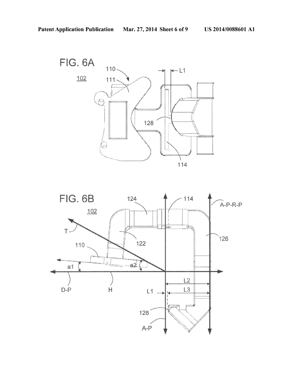 METHODS AND APPARATUS FOR PREPARING A PATIENT'S FEMUR FOR PATELLOFEMORAL     KNEE ARTHROPLASTY - diagram, schematic, and image 07