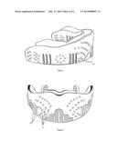 TONGUE CLEANING APPARATUS diagram and image