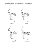 TONGUE CLEANING APPARATUS diagram and image