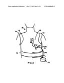 AUTOMATIC EXTERNAL DEFIBRILLATOR FOR IMPLATABLE CARDIAC DEFIBRILLATOR     PATIENTS UNDERGOING PROCEDURES INVOLVING ELECTROMAGNETIC INTERFERENCE diagram and image