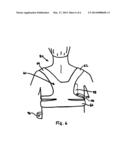 AUTOMATIC EXTERNAL DEFIBRILLATOR FOR IMPLATABLE CARDIAC DEFIBRILLATOR     PATIENTS UNDERGOING PROCEDURES INVOLVING ELECTROMAGNETIC INTERFERENCE diagram and image