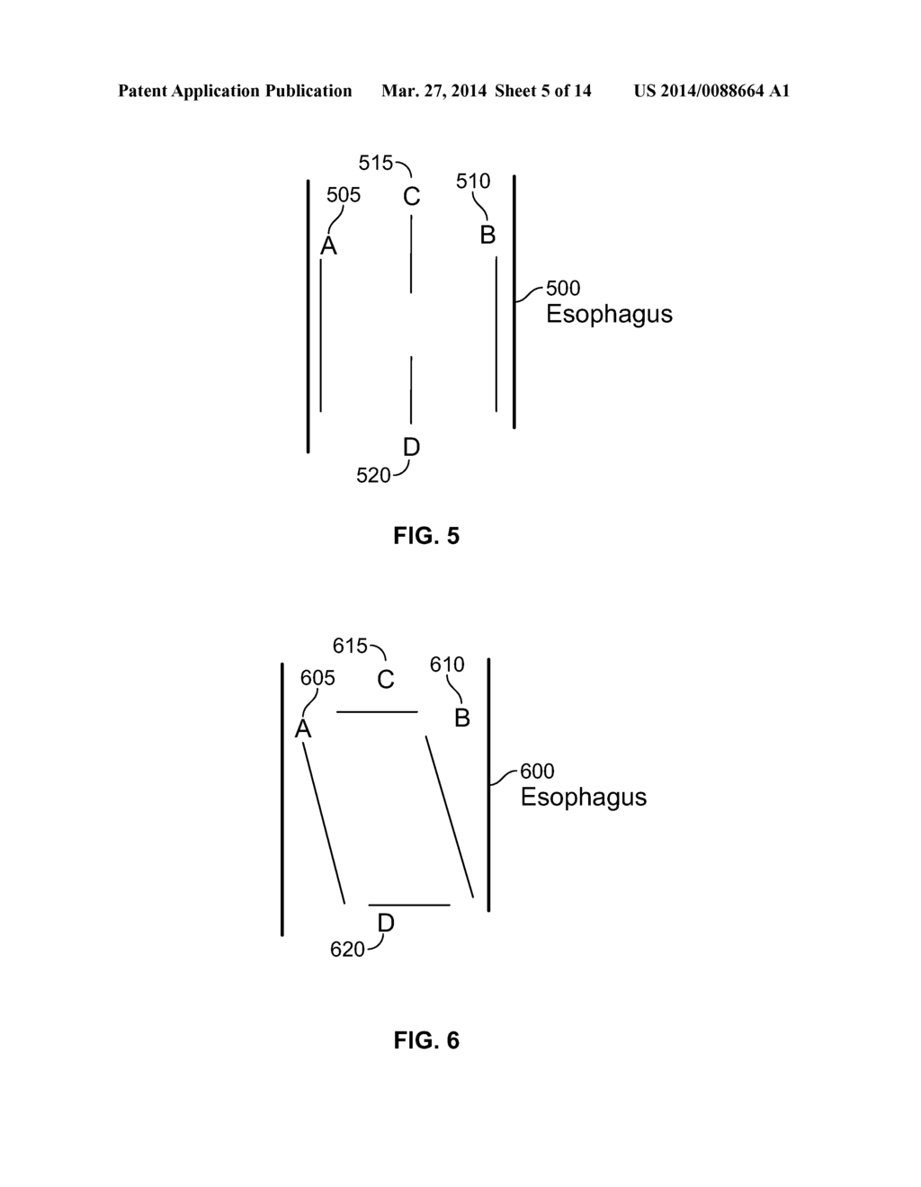 Device and Implantation System for Electrical Stimulation of Biological     Systems - diagram, schematic, and image 06