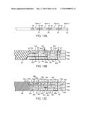 DEVICES AND METHODS FOR TISSUE MODULATION AND MONITORING diagram and image