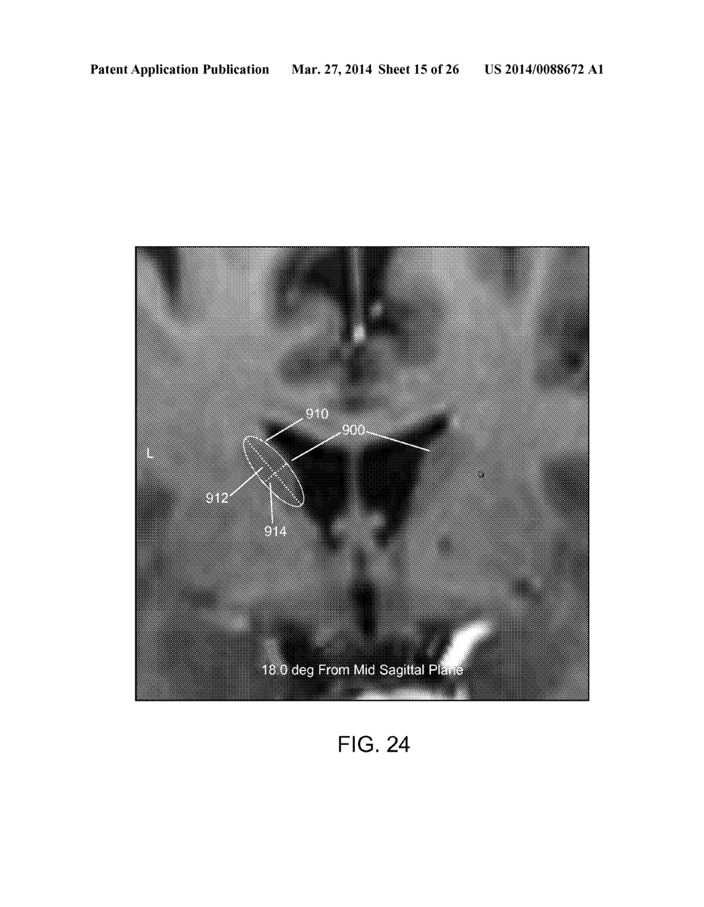 DEVICES AND METHODS FOR TISSUE MODULATION AND MONITORING - diagram, schematic, and image 16