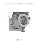 PATIENT-SPECIFIC INTRALUMINAL IMPLANTS diagram and image