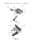 SYSTEM AND METHOD FOR AN INTERBODY SPINAL FUSION ASSEMBLY diagram and image