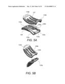 SYSTEM AND METHOD FOR AN INTERBODY SPINAL FUSION ASSEMBLY diagram and image