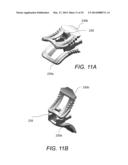 SYSTEM AND METHOD FOR AN INTERBODY SPINAL FUSION ASSEMBLY diagram and image