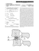 INTERVERTEBRAL IMPLANT FOR MUTUAL SITUATING OF ADJACENT VERTEBRAE diagram and image