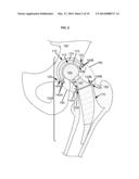 ARTIFICIAL JOINT COMPONENTS INCLUDING SYNOVIAL FLUID DEFLECTING STRUCTURES diagram and image