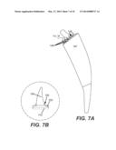 ARTIFICIAL JOINT COMPONENTS INCLUDING SYNOVIAL FLUID DEFLECTING STRUCTURES diagram and image