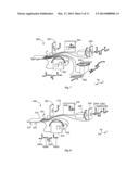 Inertial Sensor Bias Estimation by Flipping diagram and image