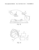 SYSTEMS AND METHODS FOR SURGICAL AND INTERVENTIONAL PLANNING, SUPPORT,     POST-OPERATIVE FOLLOW-UP, AND, FUNCTIONAL RECOVERY TRACKING diagram and image