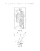 SYSTEMS AND METHODS FOR SURGICAL AND INTERVENTIONAL PLANNING, SUPPORT,     POST-OPERATIVE FOLLOW-UP, AND, FUNCTIONAL RECOVERY TRACKING diagram and image