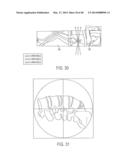 SYSTEMS AND METHODS FOR SURGICAL AND INTERVENTIONAL PLANNING, SUPPORT,     POST-OPERATIVE FOLLOW-UP, AND, FUNCTIONAL RECOVERY TRACKING diagram and image