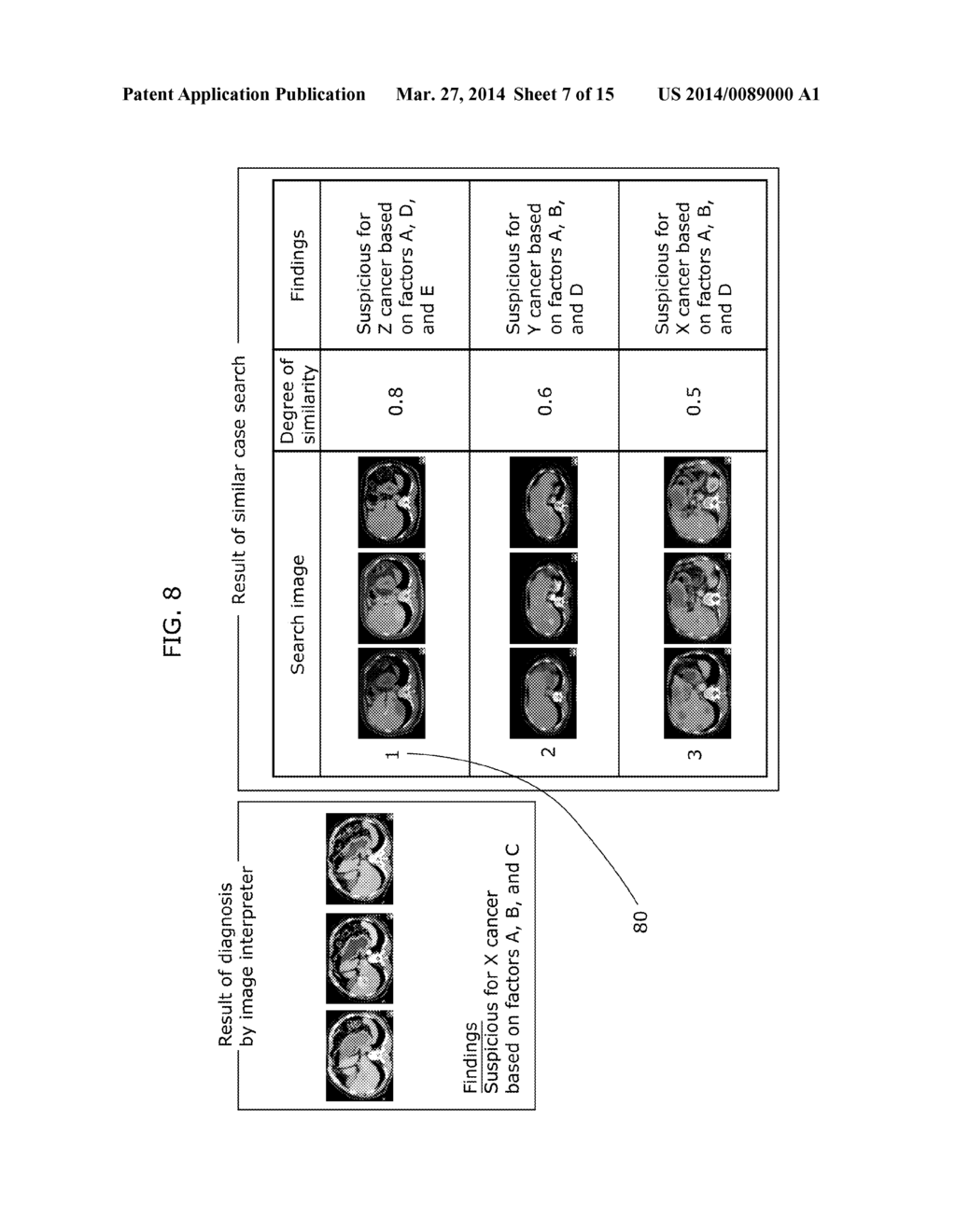 SIMILAR CASE SEARCHING APPARATUS, RELEVANCE DATABASE GENERATING APPARATUS,     SIMILAR CASE SEARCHING METHOD, AND RELEVANCE DATABASE GENERATING METHOD - diagram, schematic, and image 08