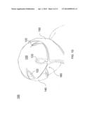 PROTECTIVE HEADGEAR SYSTEM diagram and image