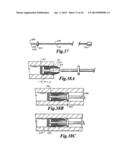 MUZZLELOADER SYSTEMS diagram and image