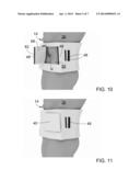 ABDOMINAL WRAP WITH WINDOW diagram and image