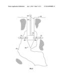 MINING DRILL WITH GRADIENT SENSING diagram and image