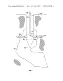 MINING DRILL WITH GRADIENT SENSING diagram and image