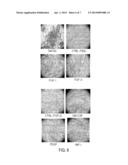 Novel Mensenchymal Stem Cells And Bone-Forming Cells diagram and image