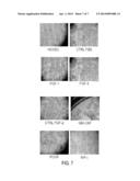 Novel Mensenchymal Stem Cells And Bone-Forming Cells diagram and image