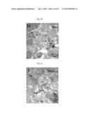 GLUTAMATE RELEASE FROM ASTROCYTE diagram and image