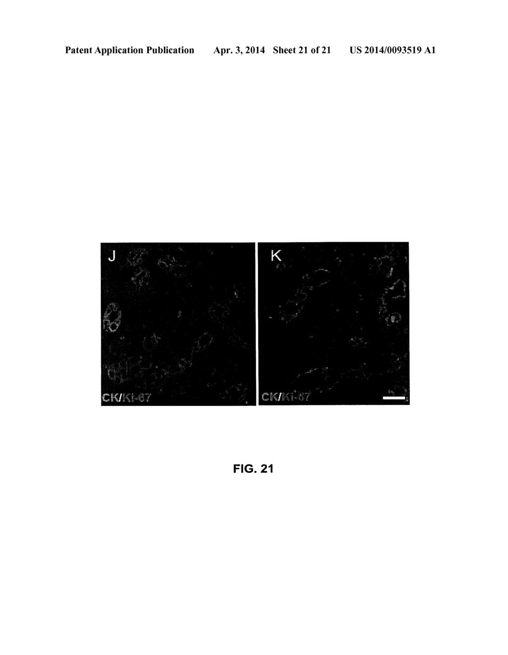 METHODS FOR PANCREATIC TISSUE REGENERATION - diagram, schematic, and image 22