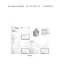 COMPOSITIONS AND METHODS FOR GLIOBLASTOMA TREATMENT diagram and image