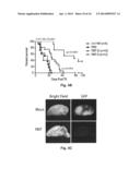 COMPOSITIONS AND METHODS FOR GLIOBLASTOMA TREATMENT diagram and image